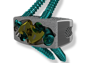 ChoiceSpine™ Announces Line Extension of their Harrier™ Stand-Alone Anterior Lumbar Interbody Fusion System